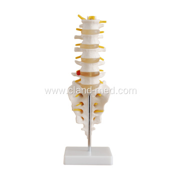 Medical Life-Size Lumbar Vertebrae